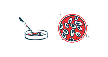 MeCP2 protein in Rett | Rett Syndrome News | cells under study in lab