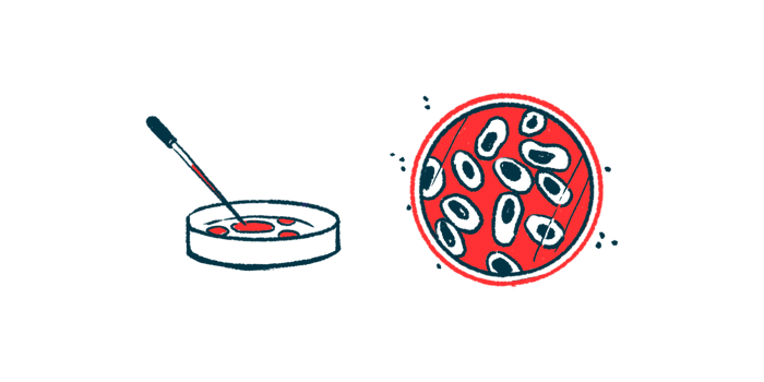ZNF483 zinc finger protein 483/Rett Syndrome News/cells in petri dish in lab illustration