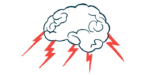 Bolts of lightning shoots out of the bottom of a brain as if it's a storm cloud.