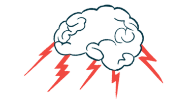 Bolts of lightning shoots out of the bottom of a brain as if it's a storm cloud.