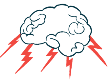 Bolts of lightning shoots out of the bottom of a brain as if it's a storm cloud.
