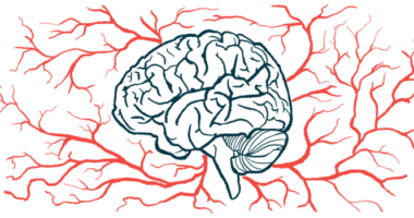 An illustration of a human brain surrounded by blood vessels.