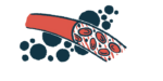An illustration shows red blood cells flowing through a blood vessel.