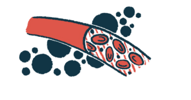 An illustration shows red blood cells flowing through a blood vessel.