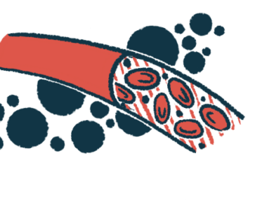 An illustration shows red blood cells flowing through a blood vessel.